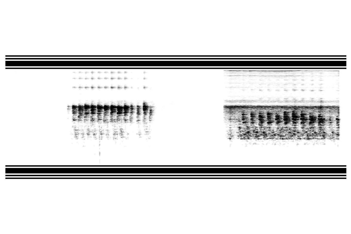 LATIDO DEL SONIDO DE UN FETO