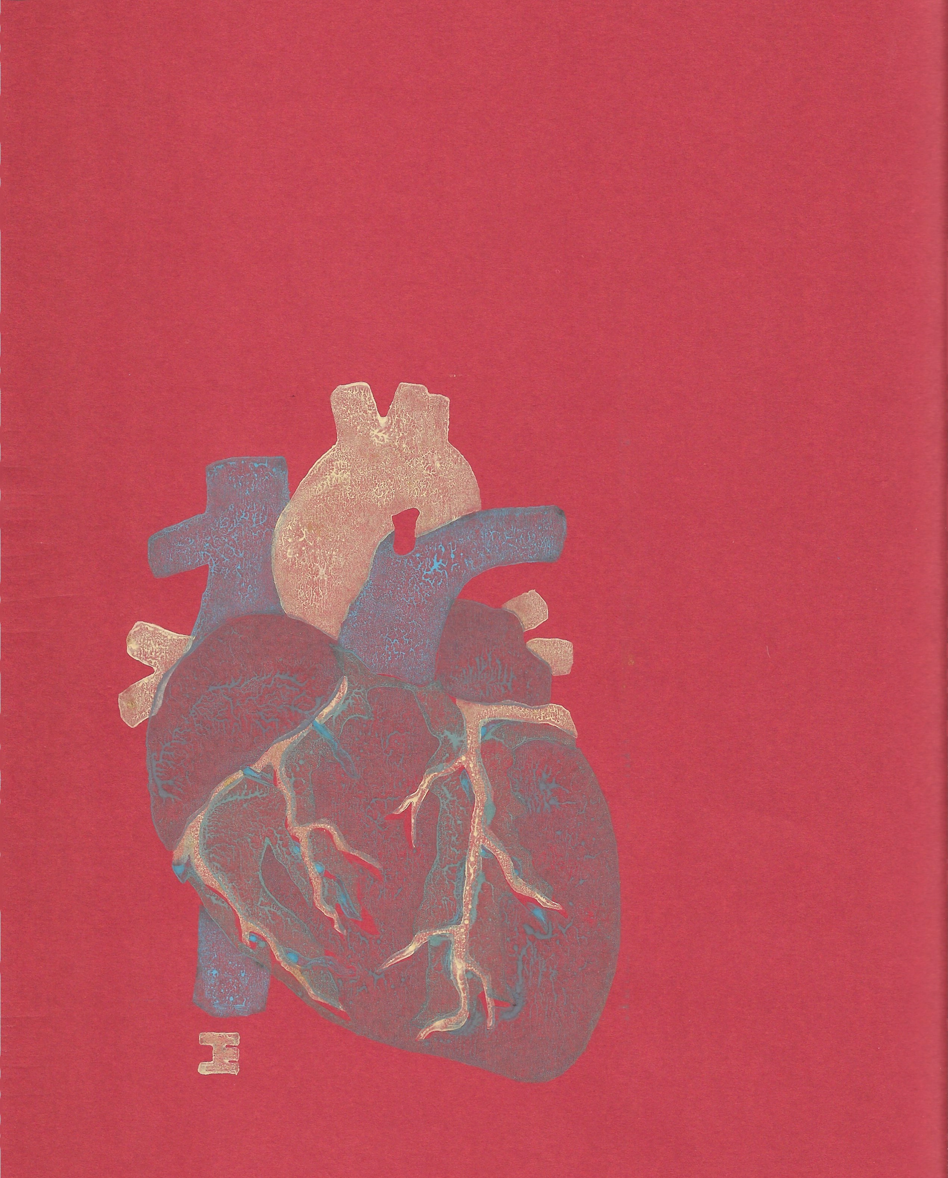 IV
