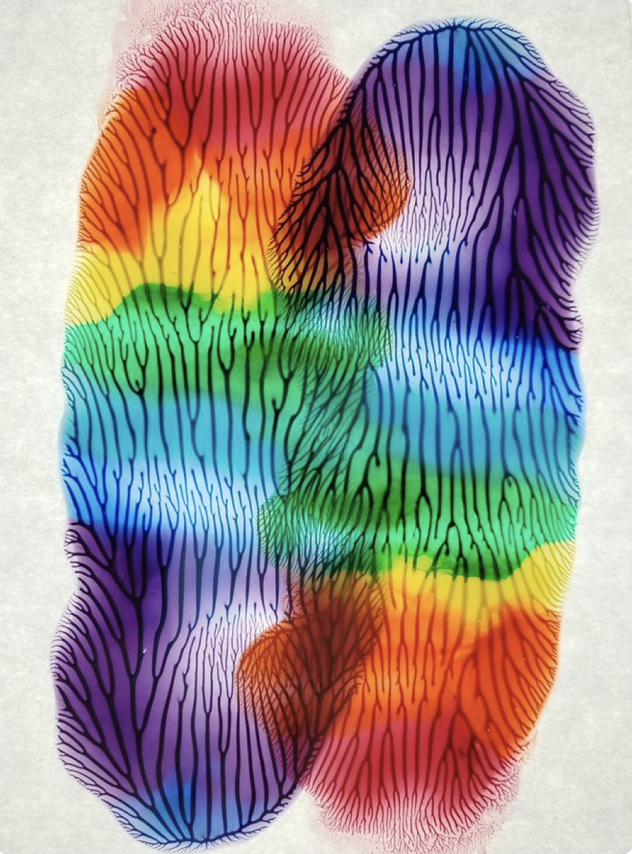 "Hugging Rainbows", Suzuki Eric
