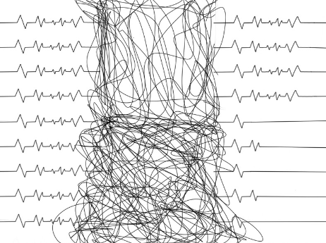 2D Exploration