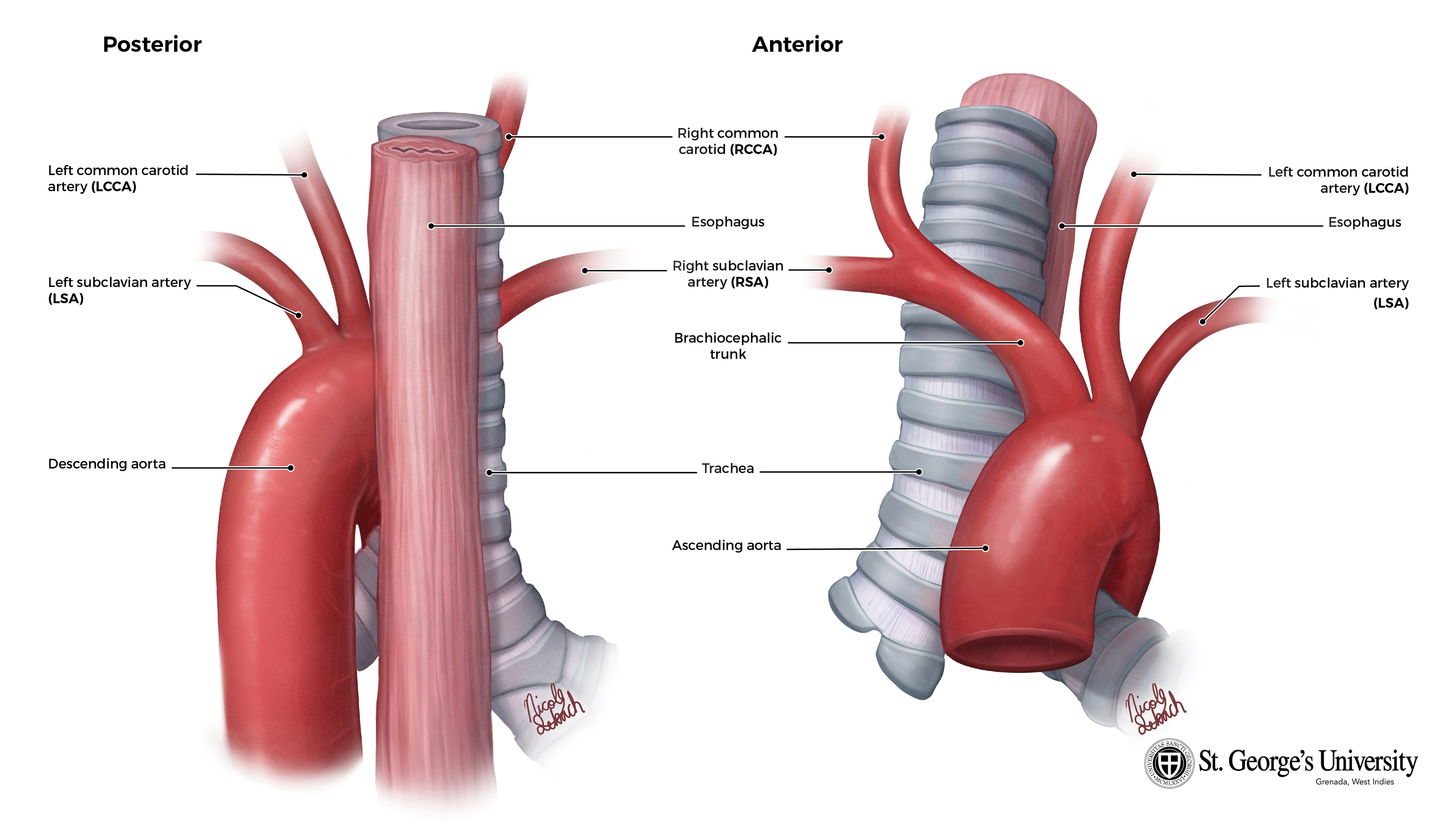 Arteria Lusoria - St. George's University