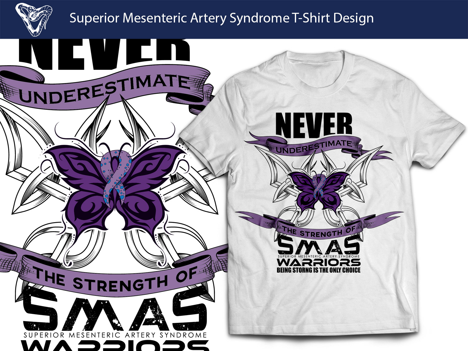 SMAS