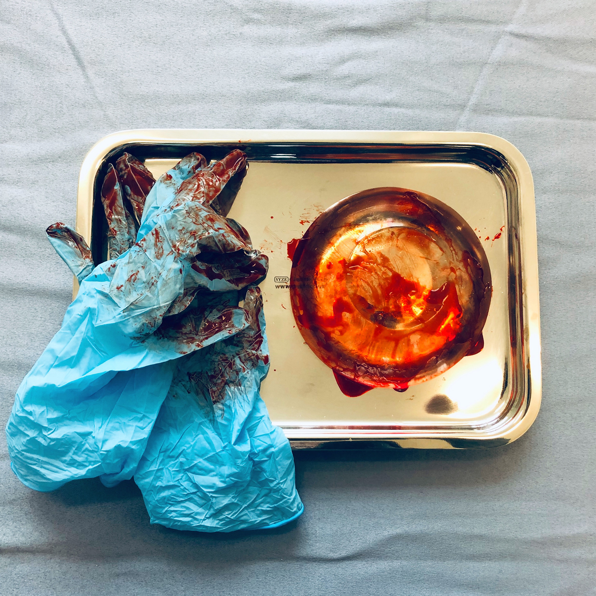 Breast Implant, 2019 resin, acrylic, latex gloves, metal