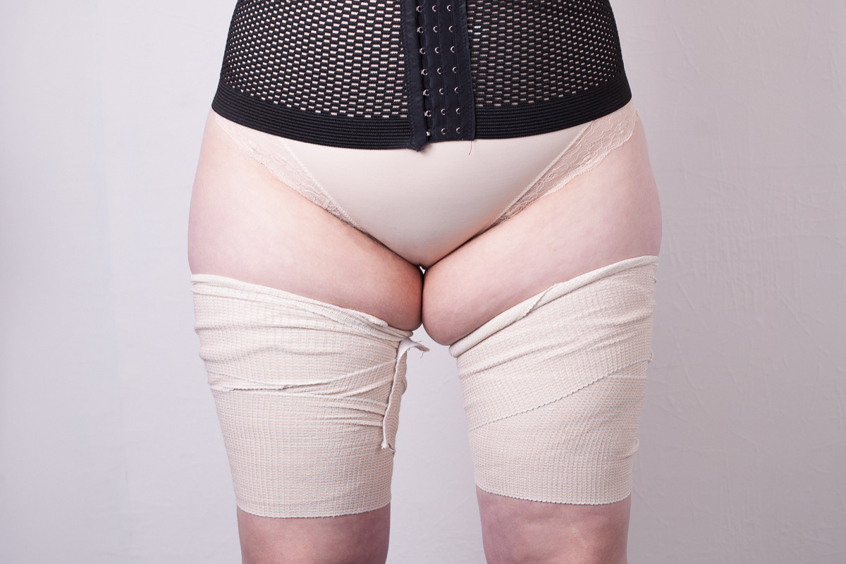 FAT 1
