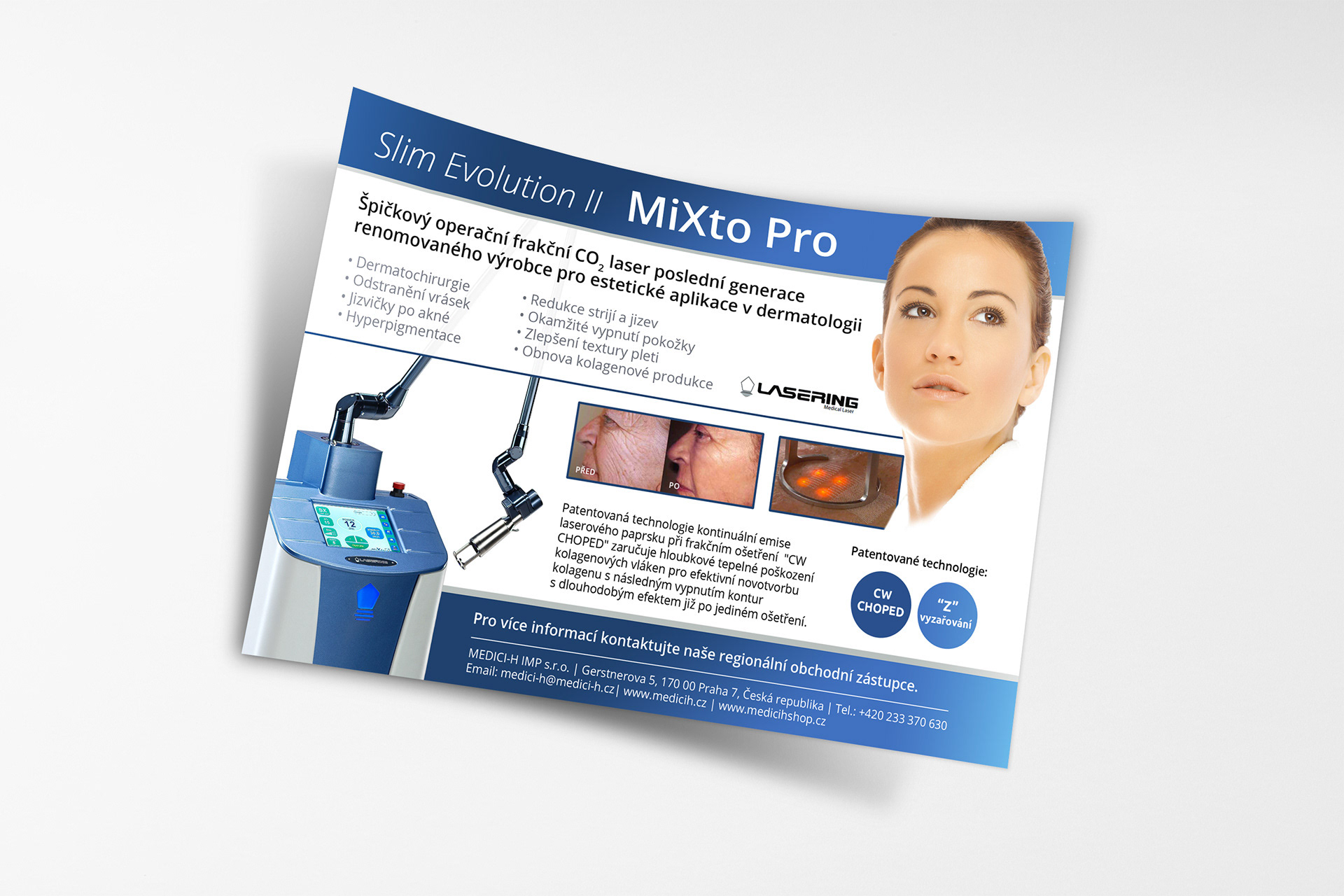 MiXto Pro - Lasering