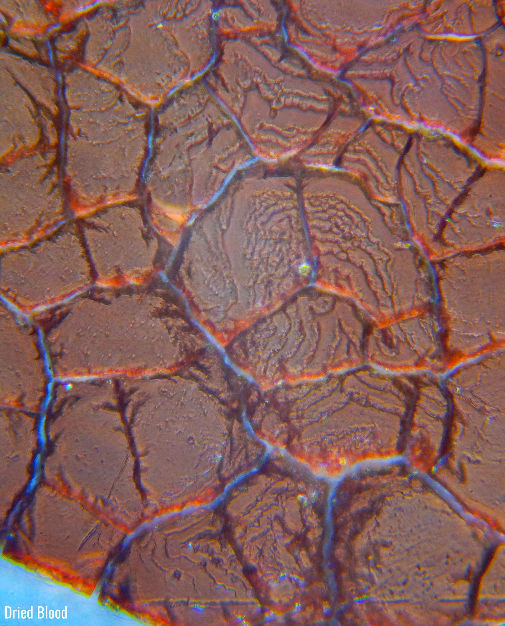 dried blood