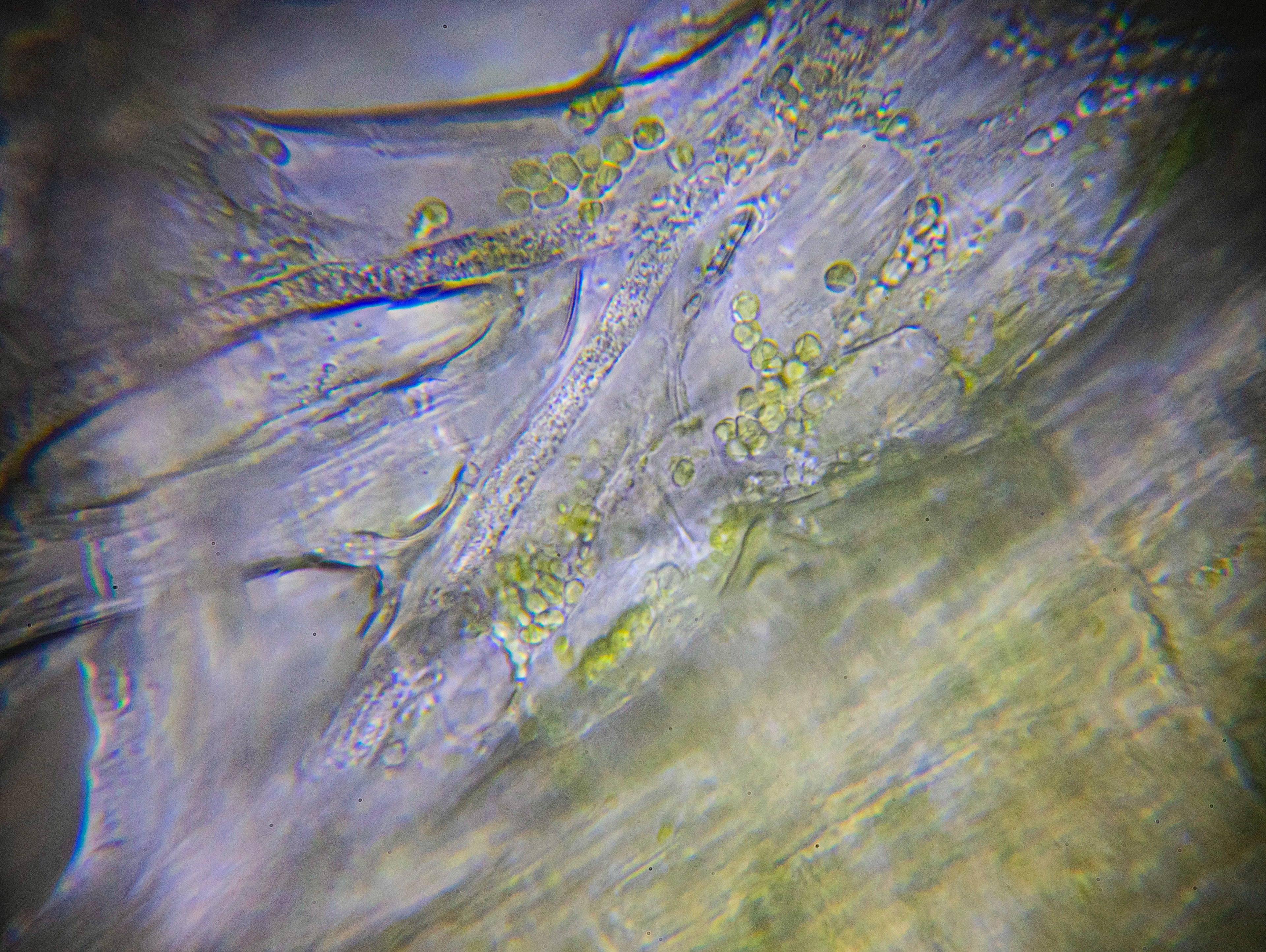 dandelion stalk x100