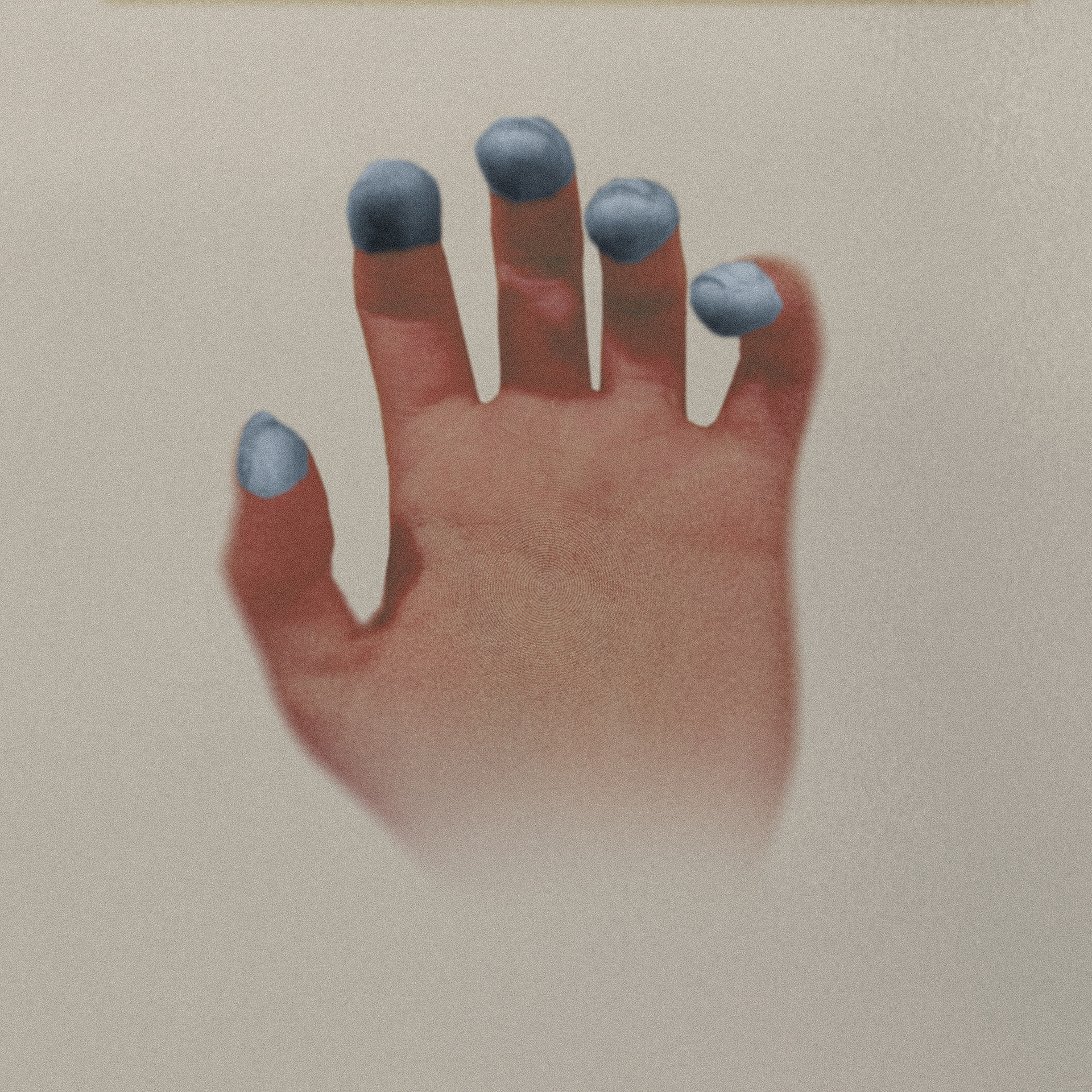 44