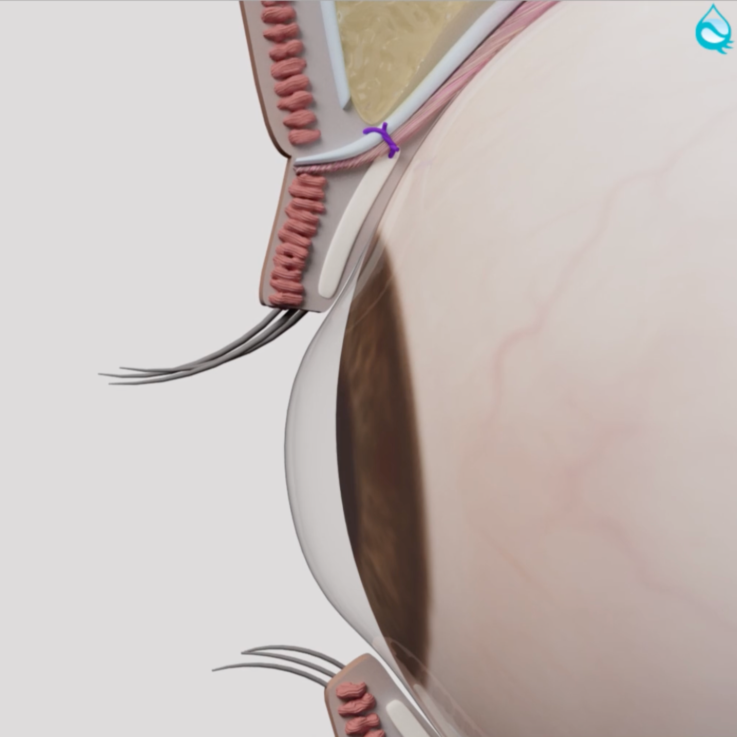 Anatomy of an eyelid, after BLEPHAROPLASTY SURGERY