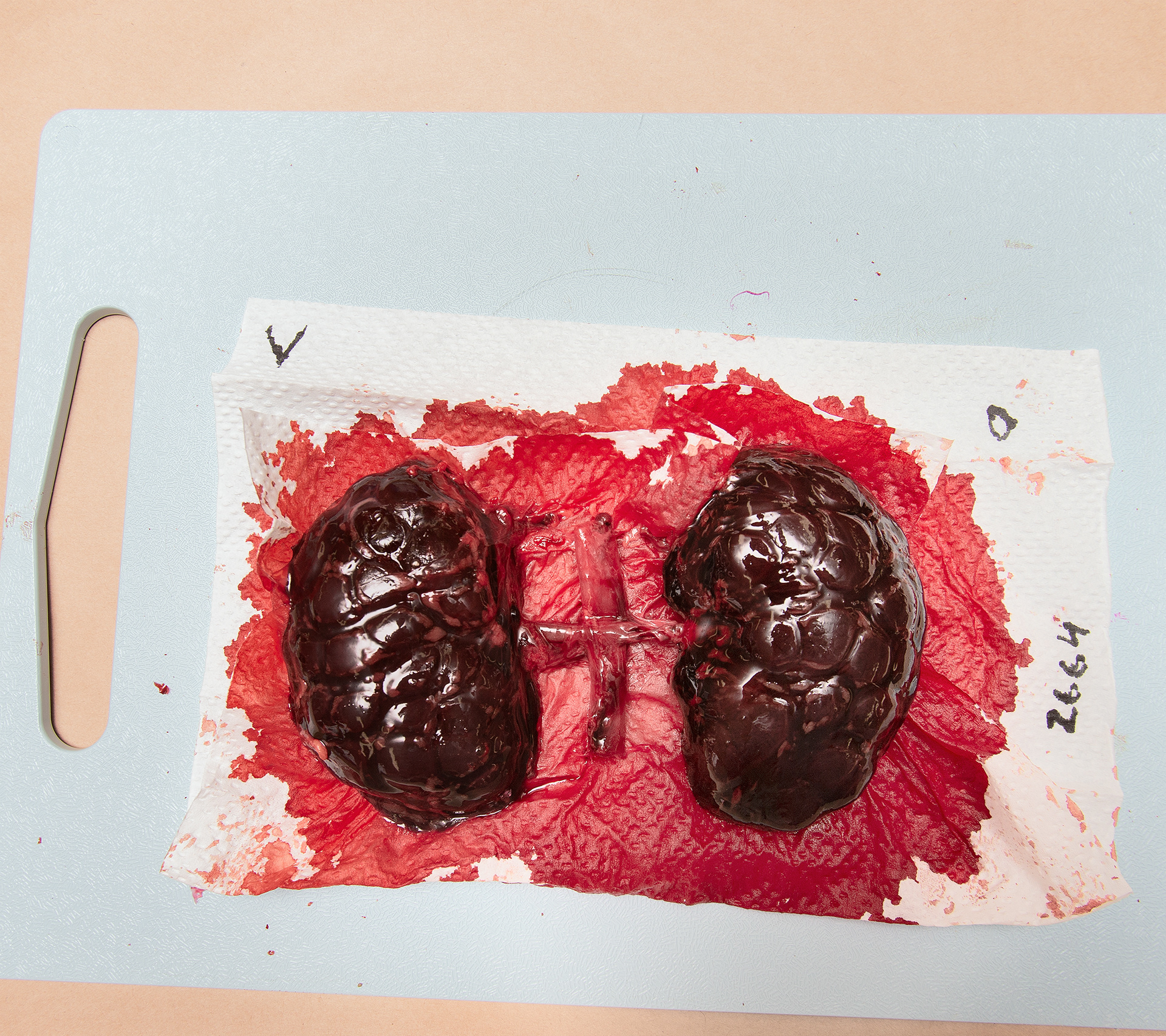 Untitled (Kidneys)