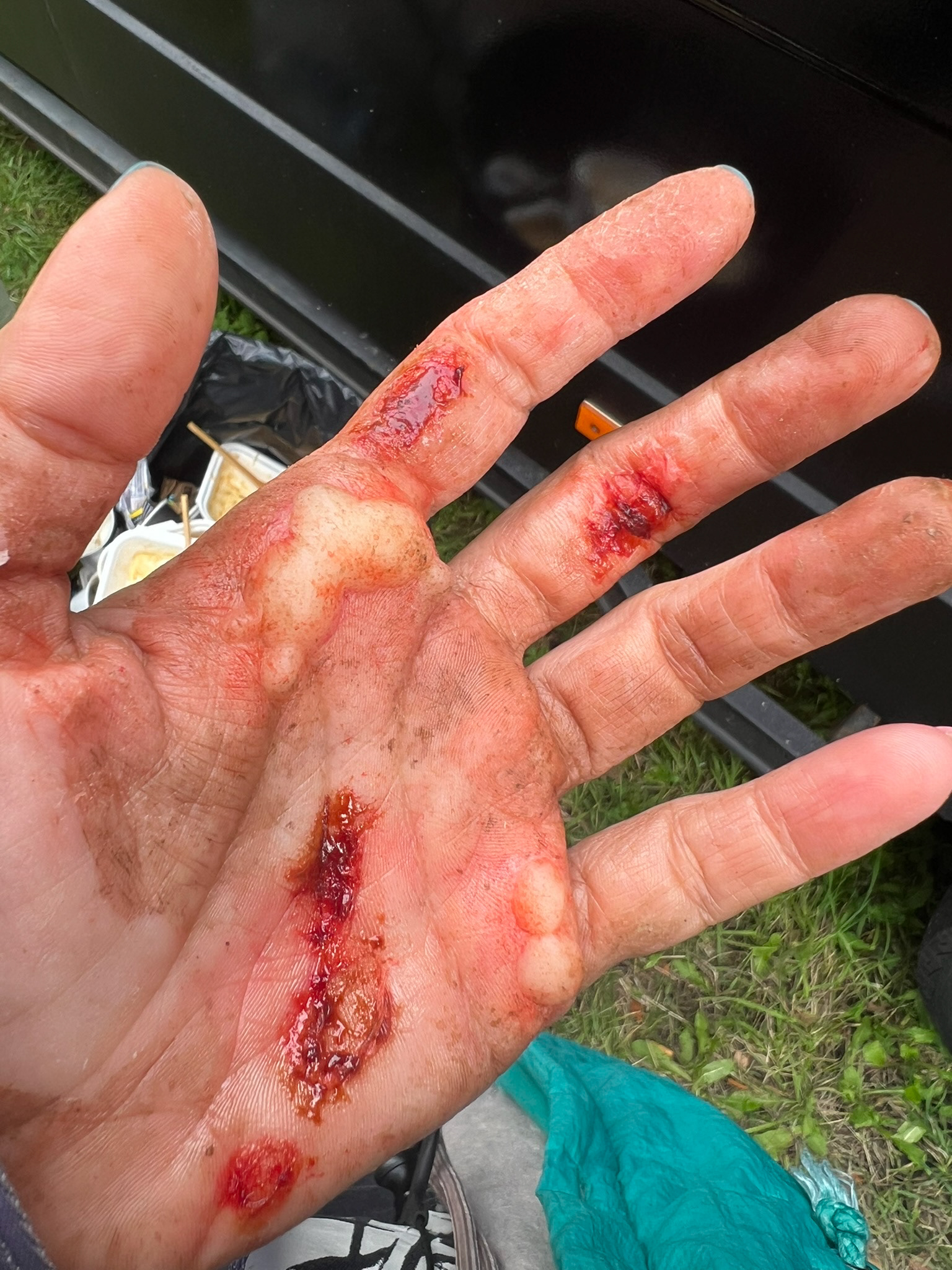 blister-transfers test makeup