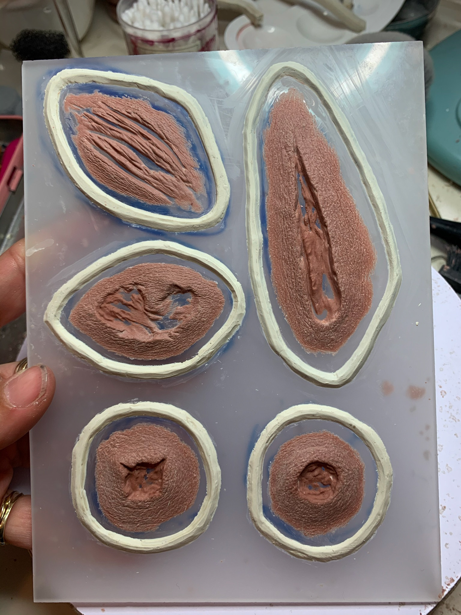 various trauma flatmoulds