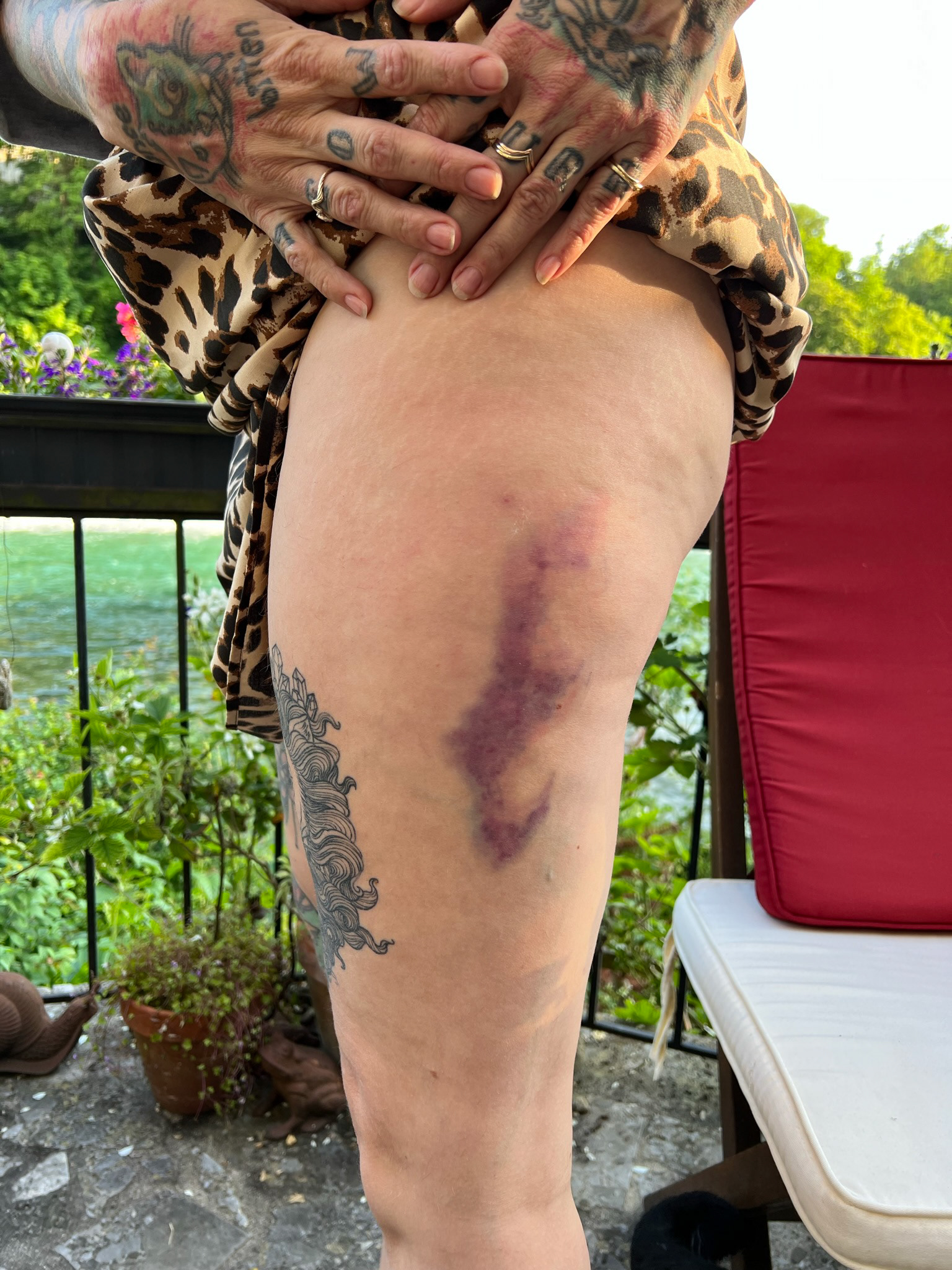 bruise transfer test