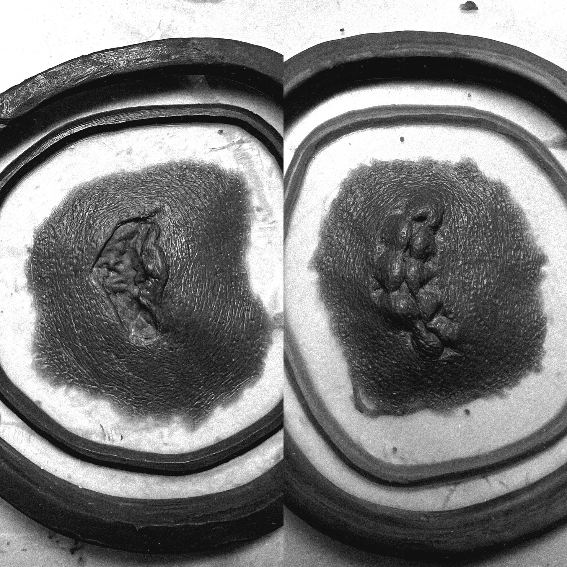 Fresh and Stitched Up Wound - "The Restauration of Grayson Manor" 2025