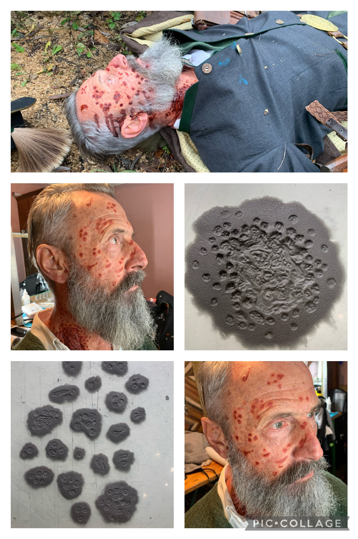 Shotgun Wound for a documentary 2019