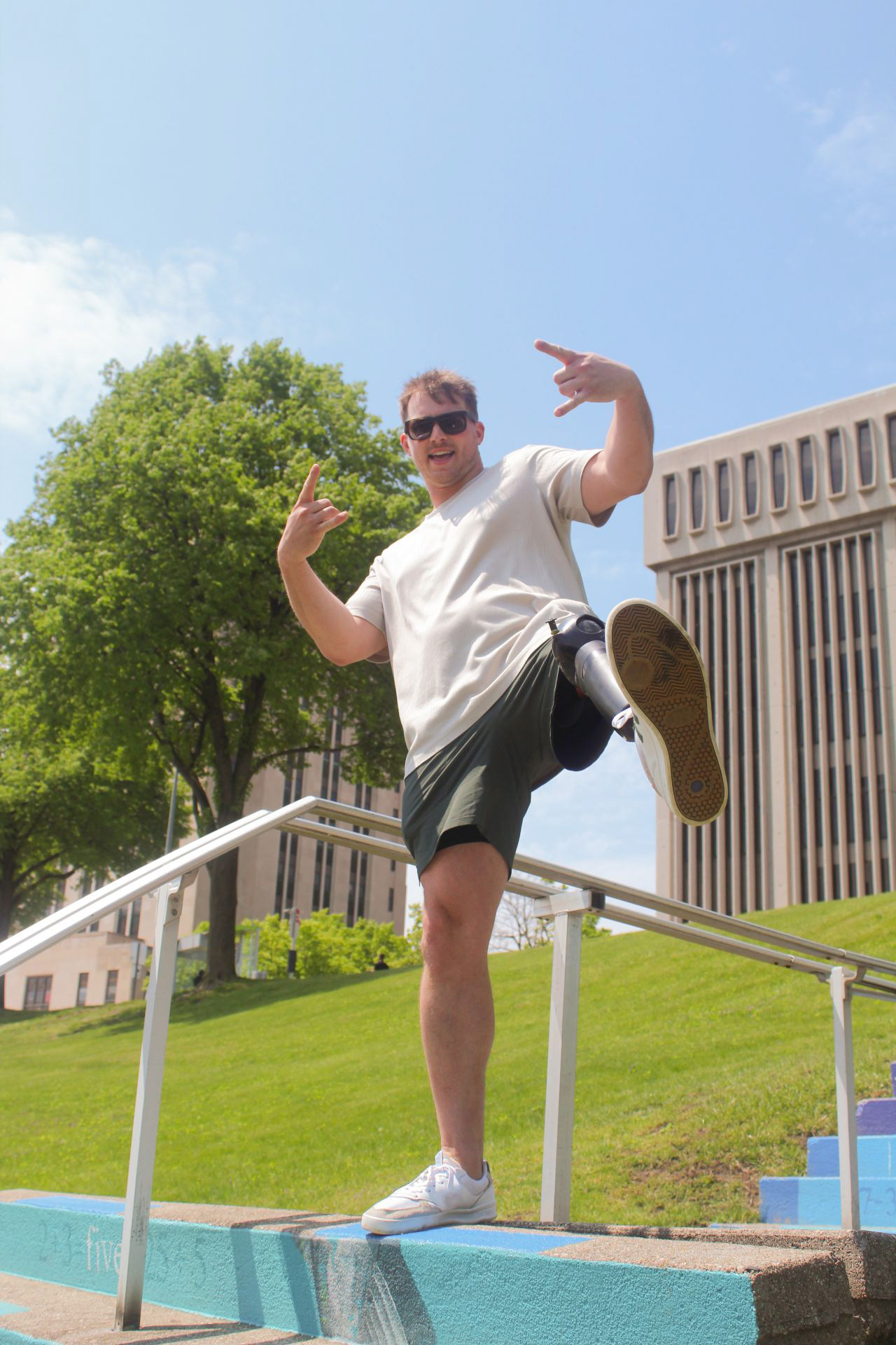 Patient photo of Jake wearing our Icon microprocessor knee