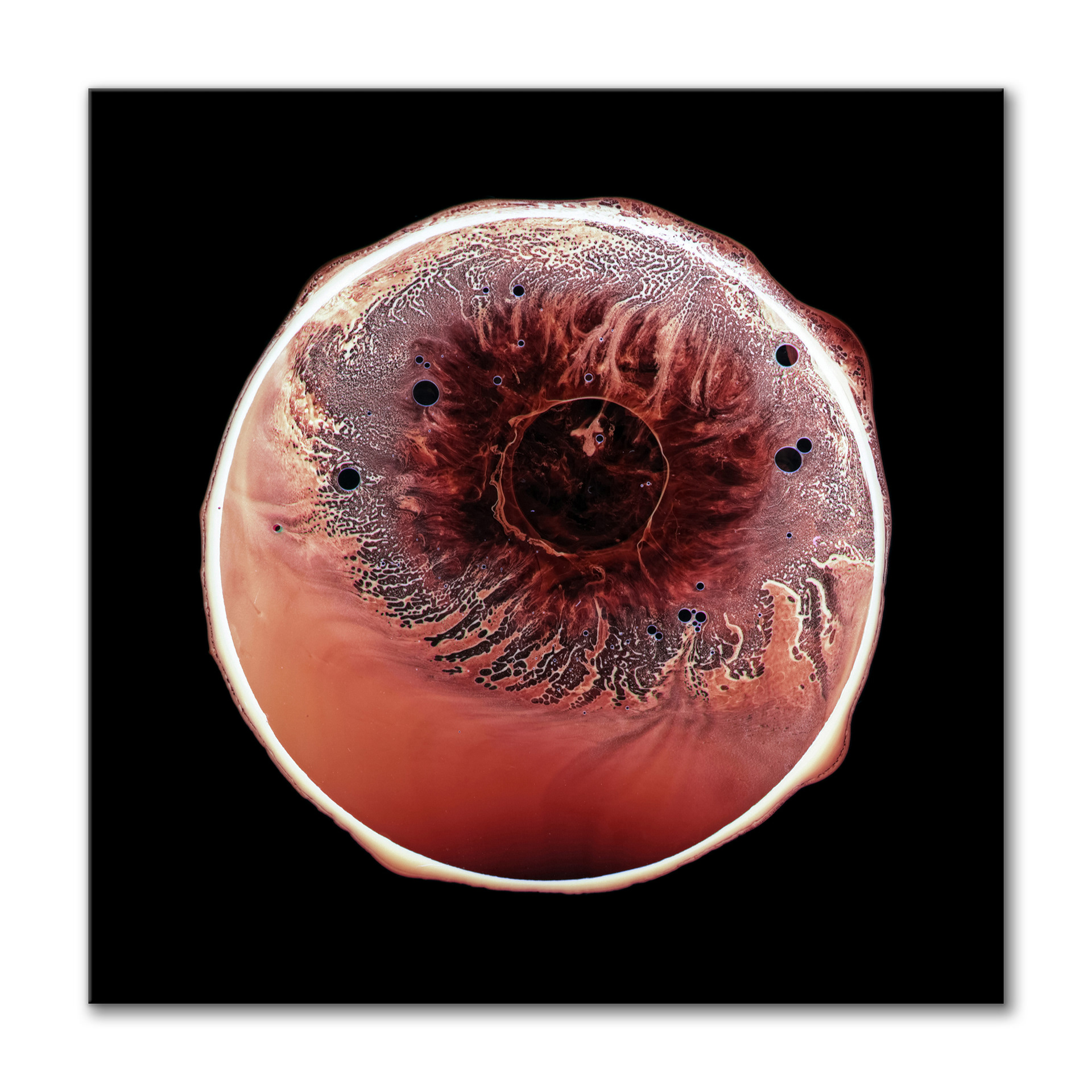 Retina I