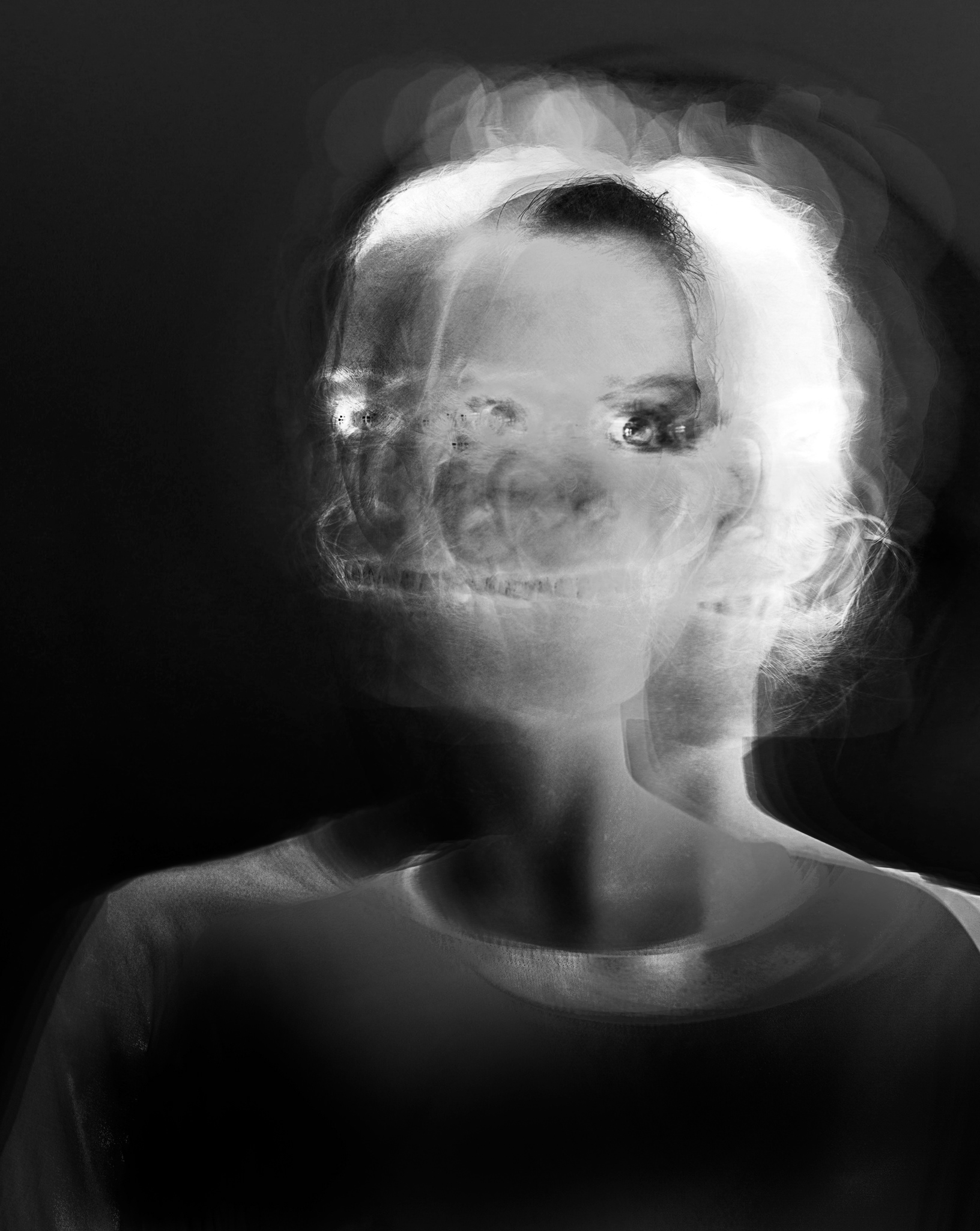 Mono x-ray