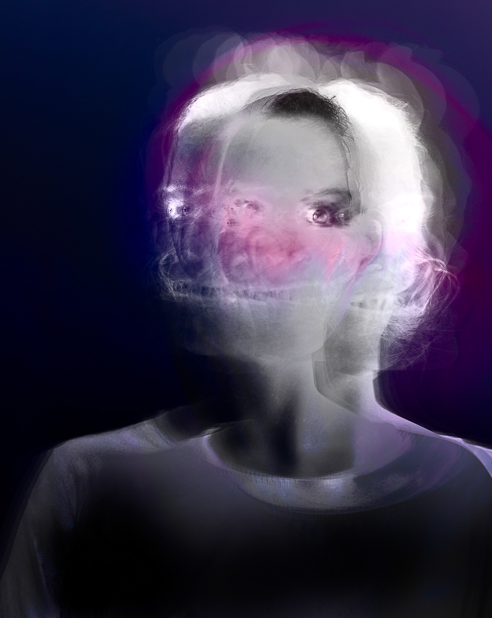 X-ray