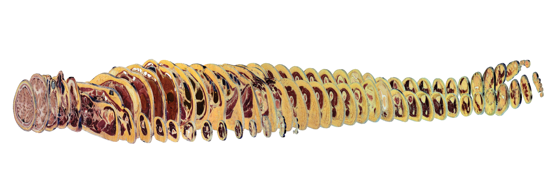 Real cadaver frozen slices