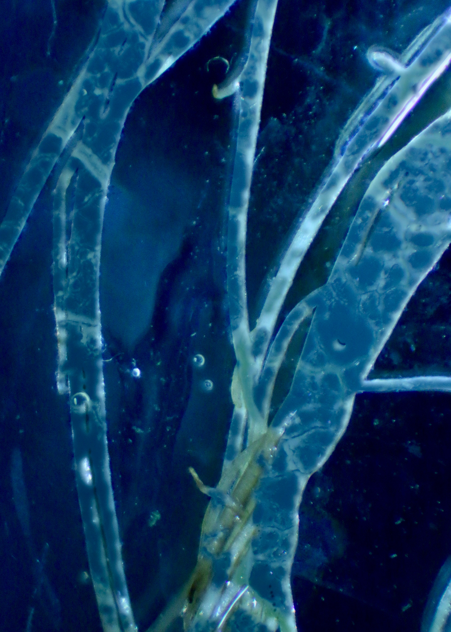 Entwine | Plasmodial slime mold image meshed with an image of roots under the dissection scope
