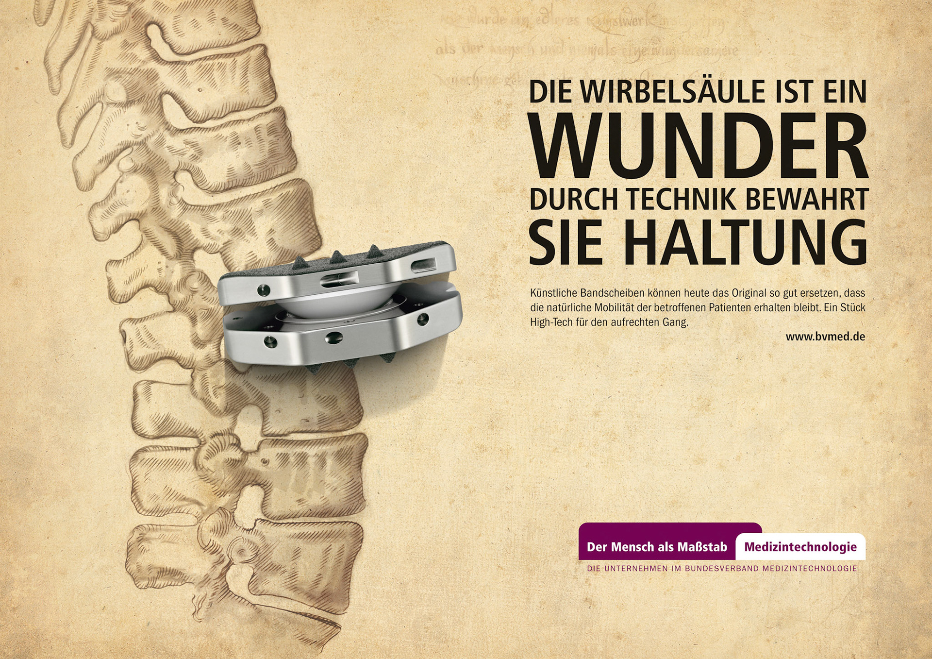Poster 18/1 "Künstliche Bandscheibe"