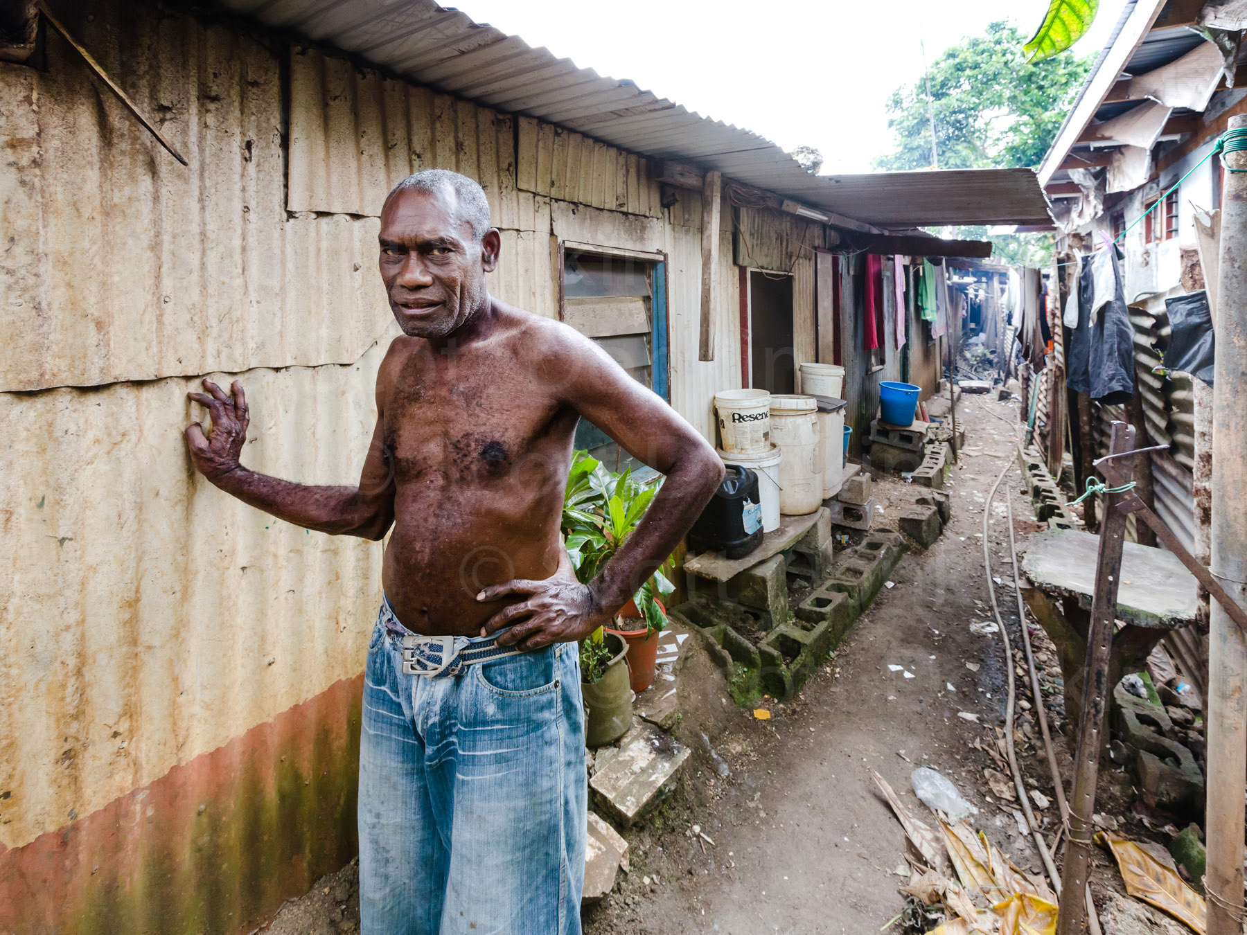 PORT VILA, VANUATU - 4 November 2012:  A resident of Seachange outside his home.  Seachange has several resorts, bars and hotels within 100 metres of the Shanty Town.  In their post vacation accommodation reviews, holiday makers regularly complain they were not made aware of the proximity to the densely populated area of corrugated metal housing.