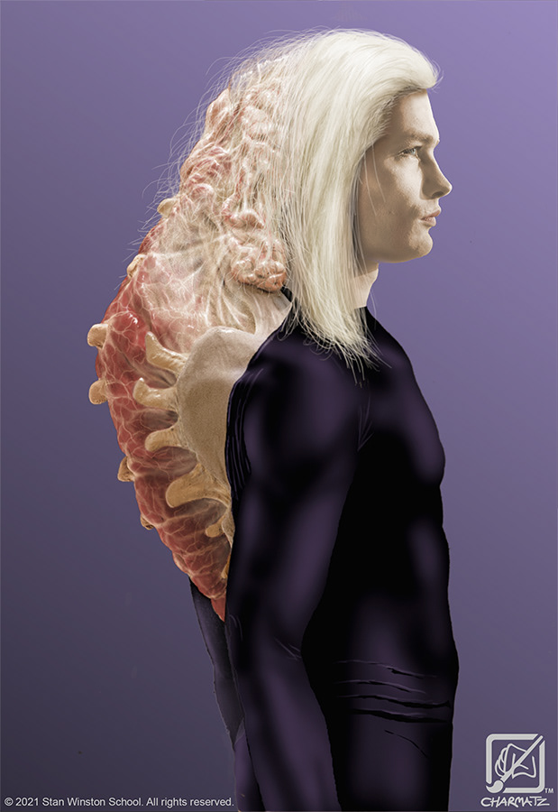 Über Morlock