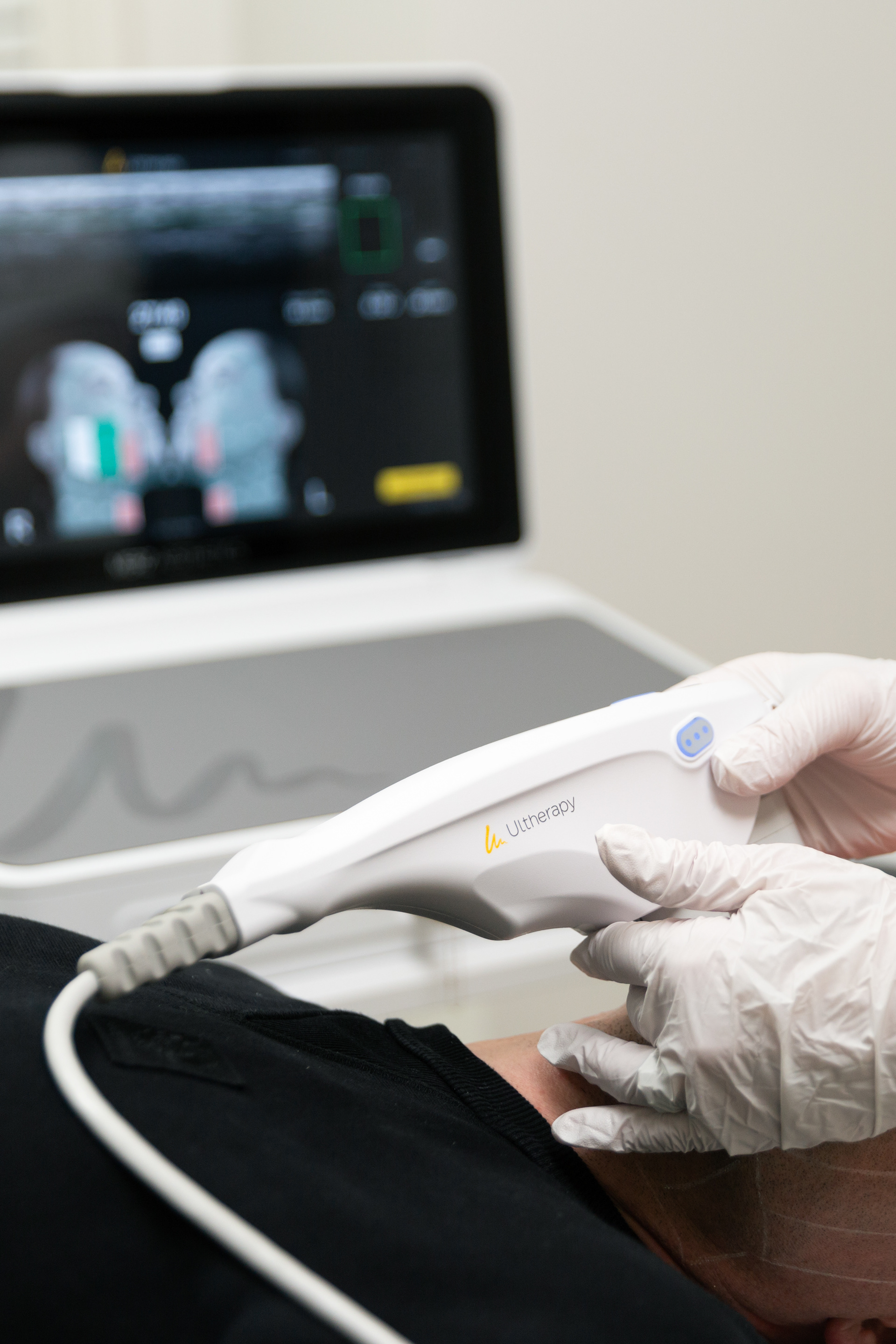 Ultherapy | Merz Aesthetics
