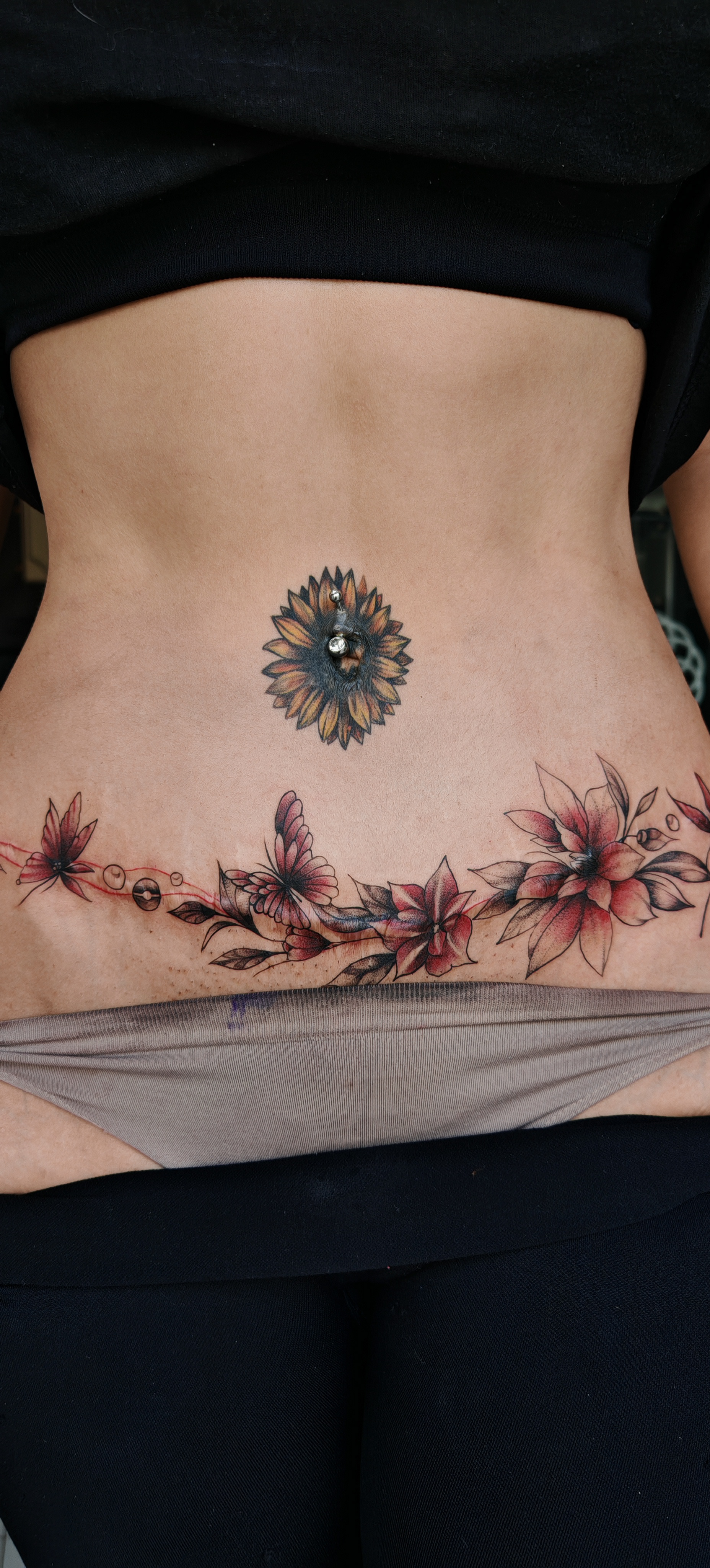 Scar tissue Cover-up After