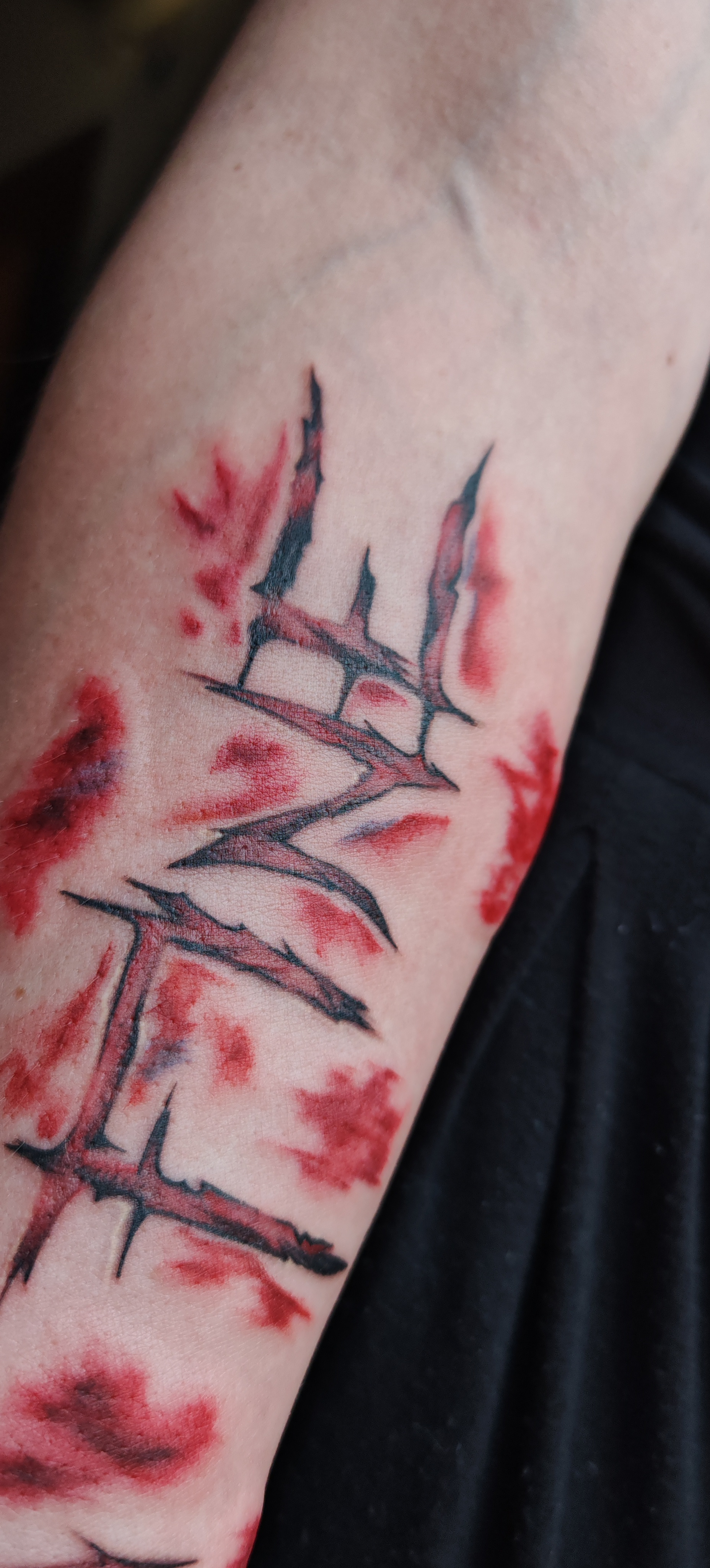 Bruise-Style