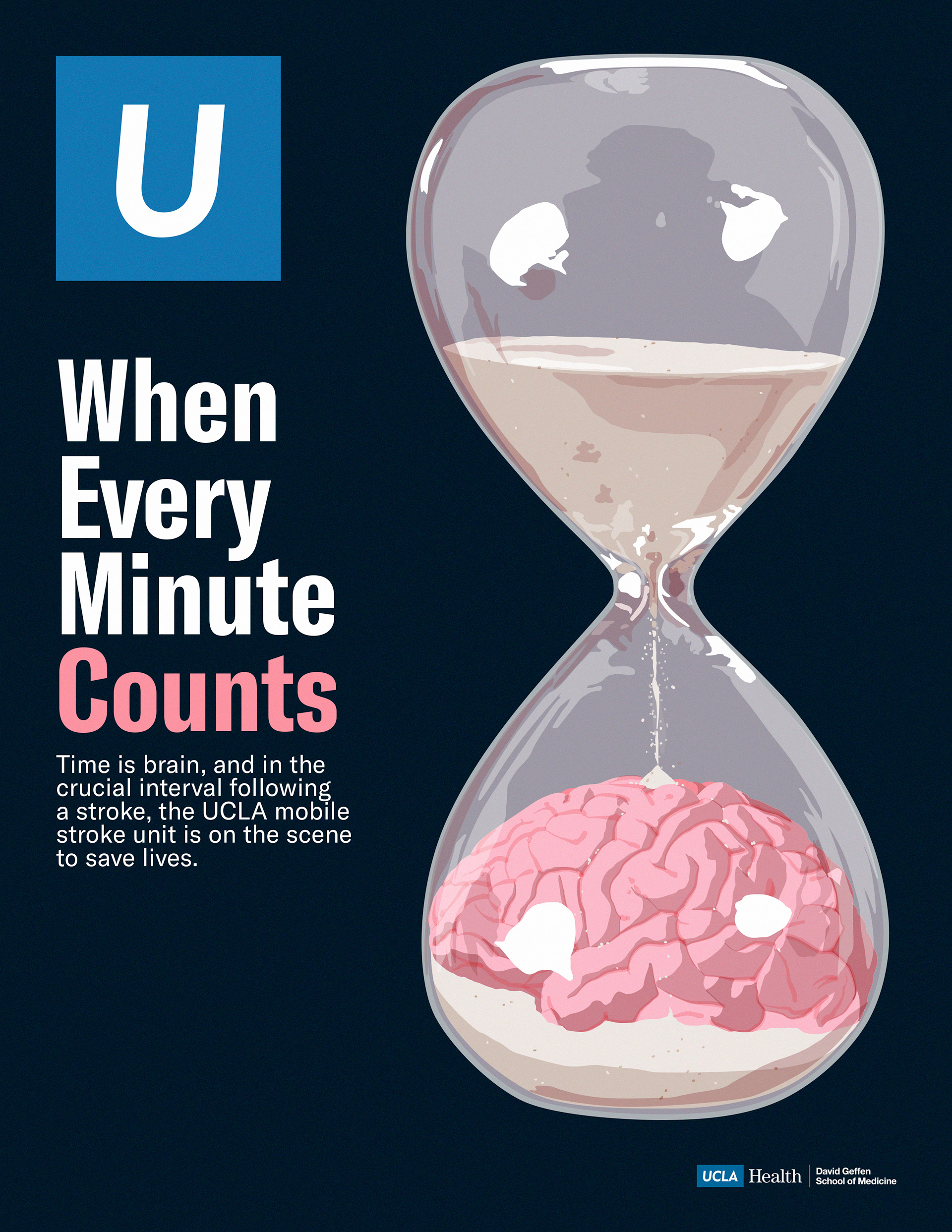 Time is brain - UCLA