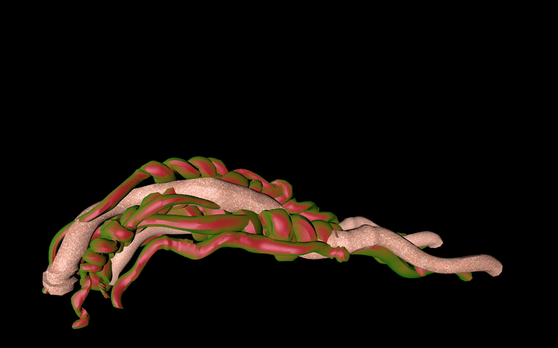 Limberic