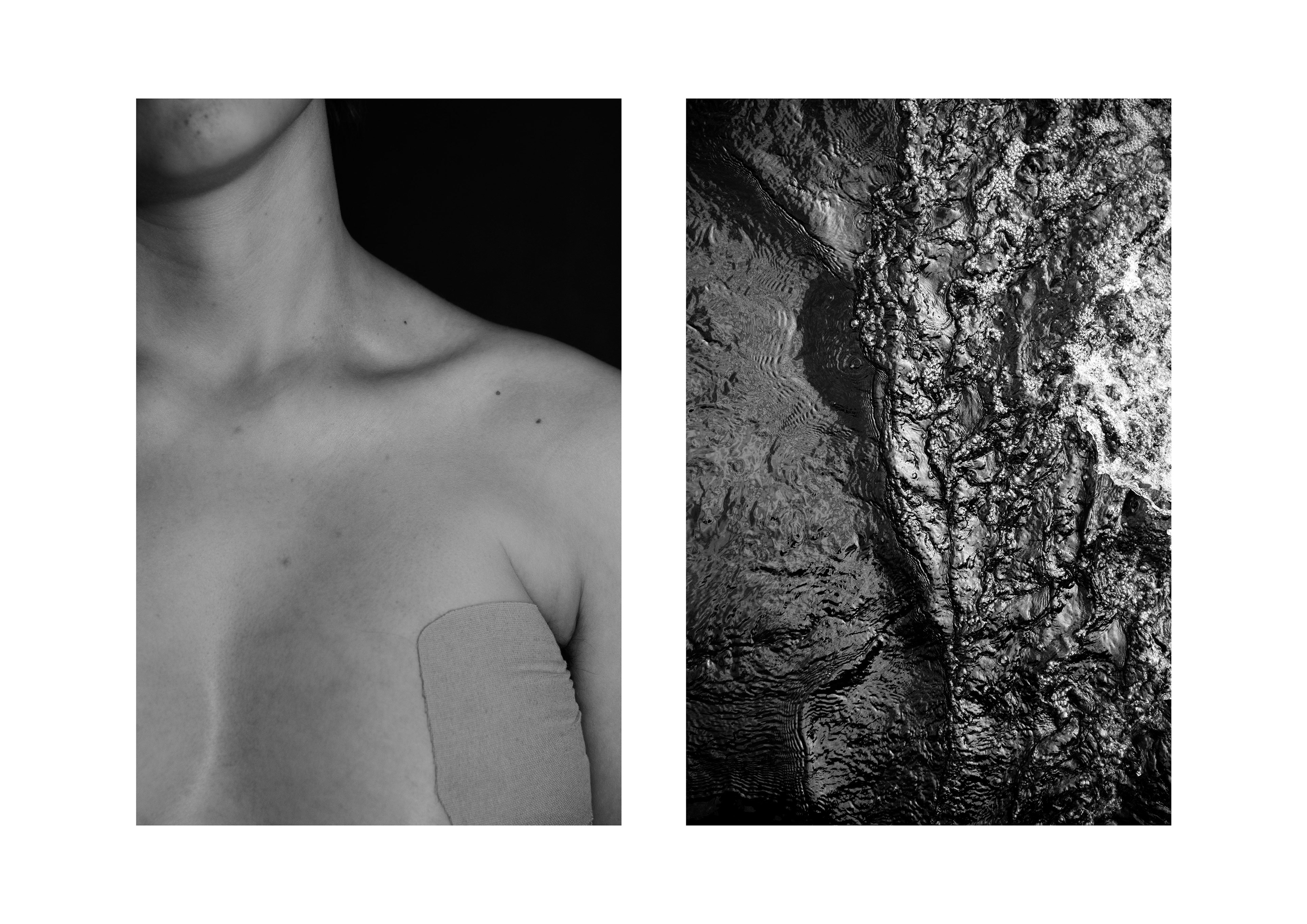 Uncontained