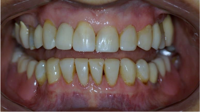 3 MONTHS REVIEW