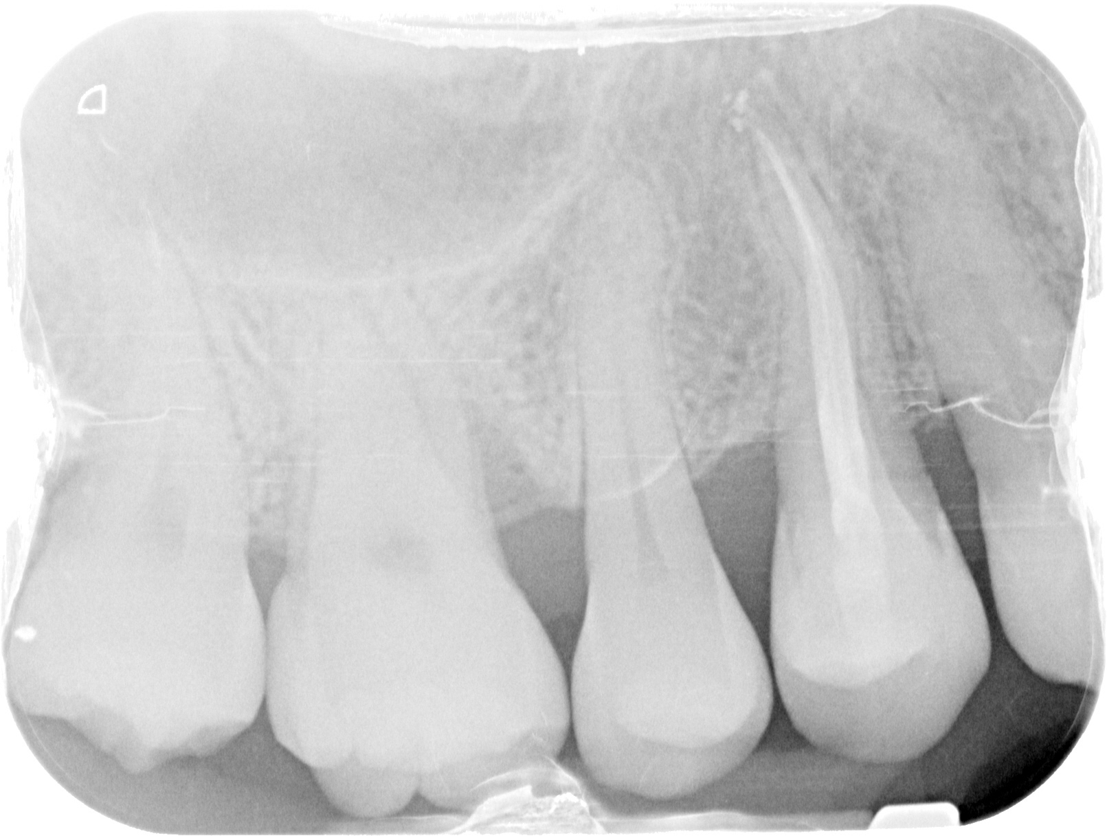 3 MONTHS FOLLOW UP