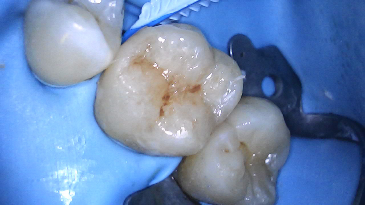 Anatomy and caracterisation