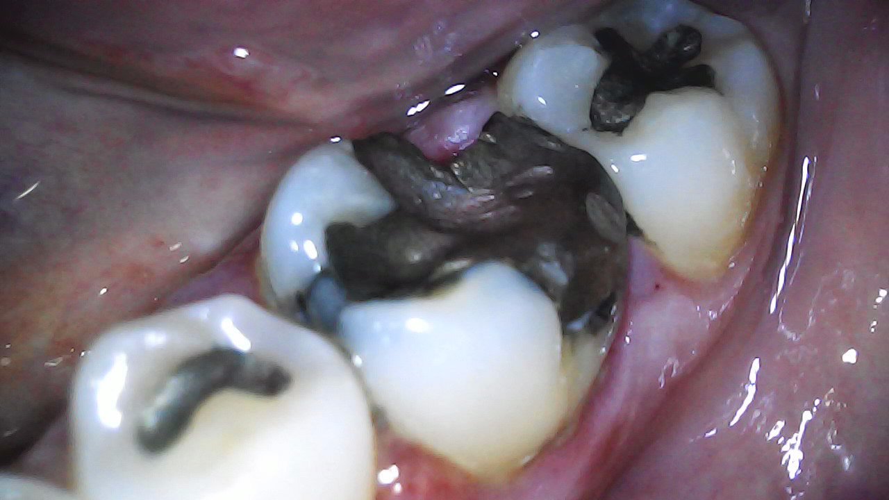 Before
