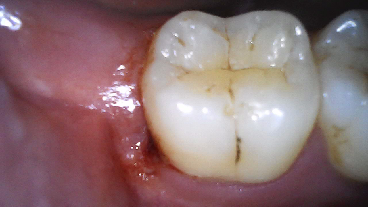 Before
