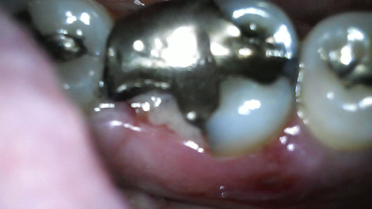 Before