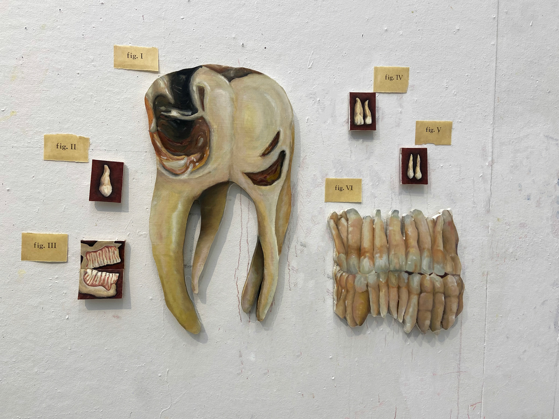 Teeth Study Diagram: Decay & Deception, Oil Paint, Multiple Surfaces