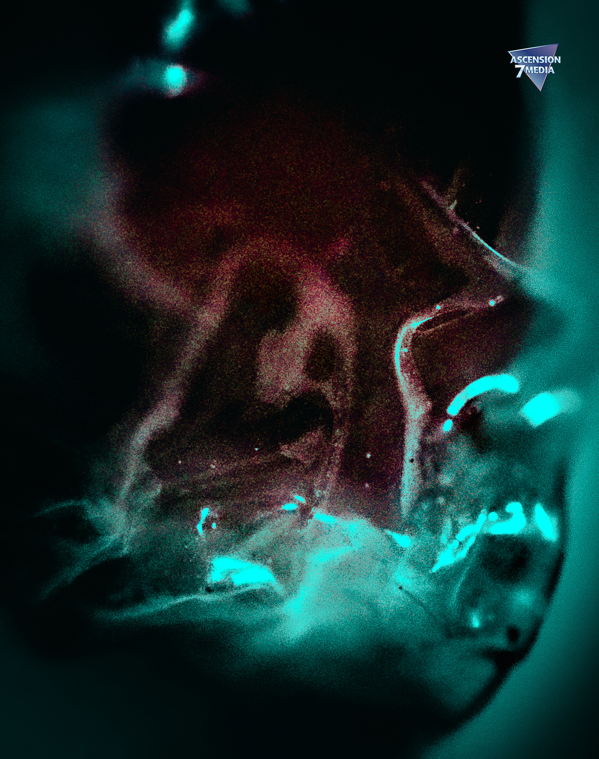 The Watcher