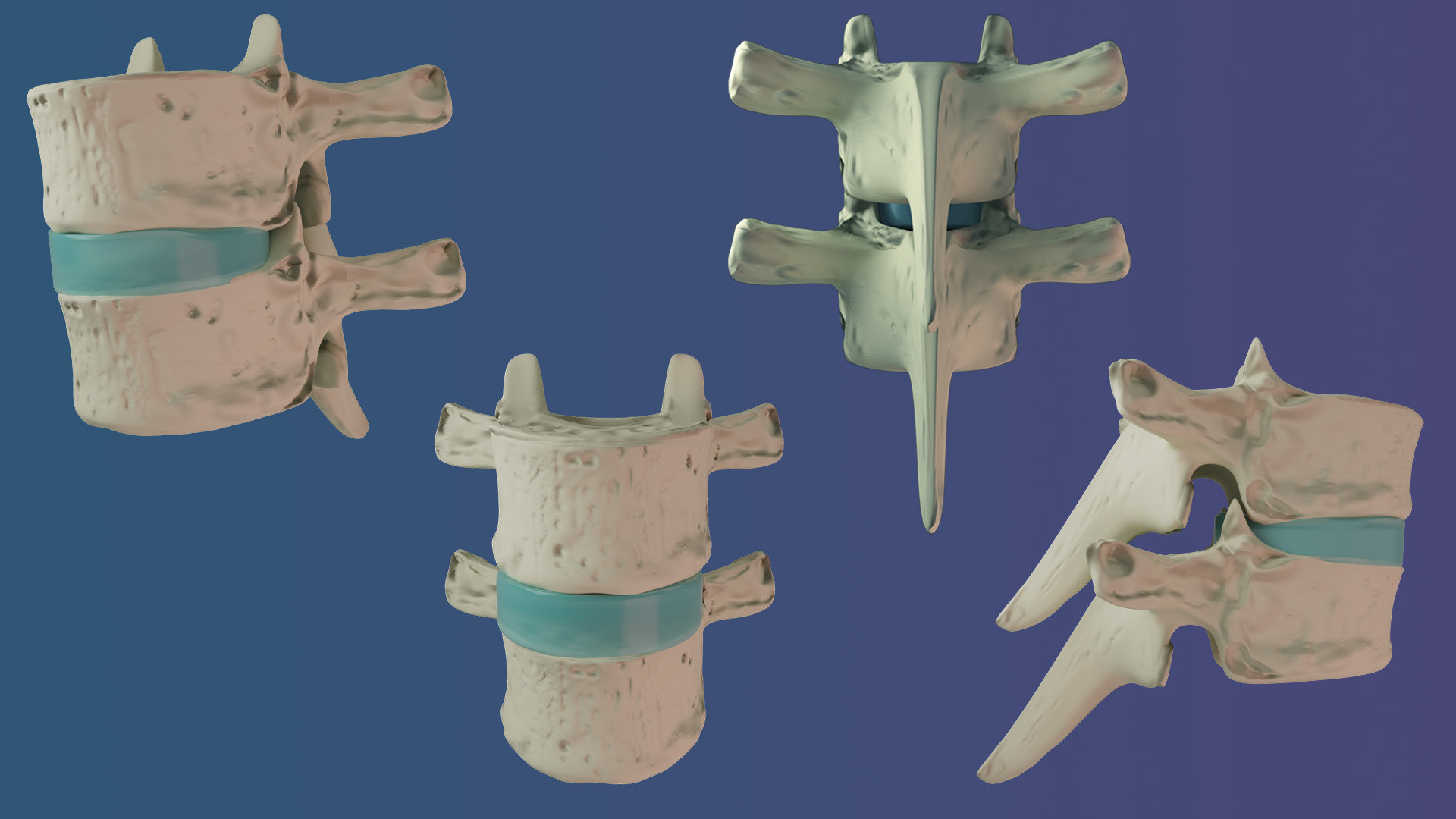 Two Articulating Vertebrae
