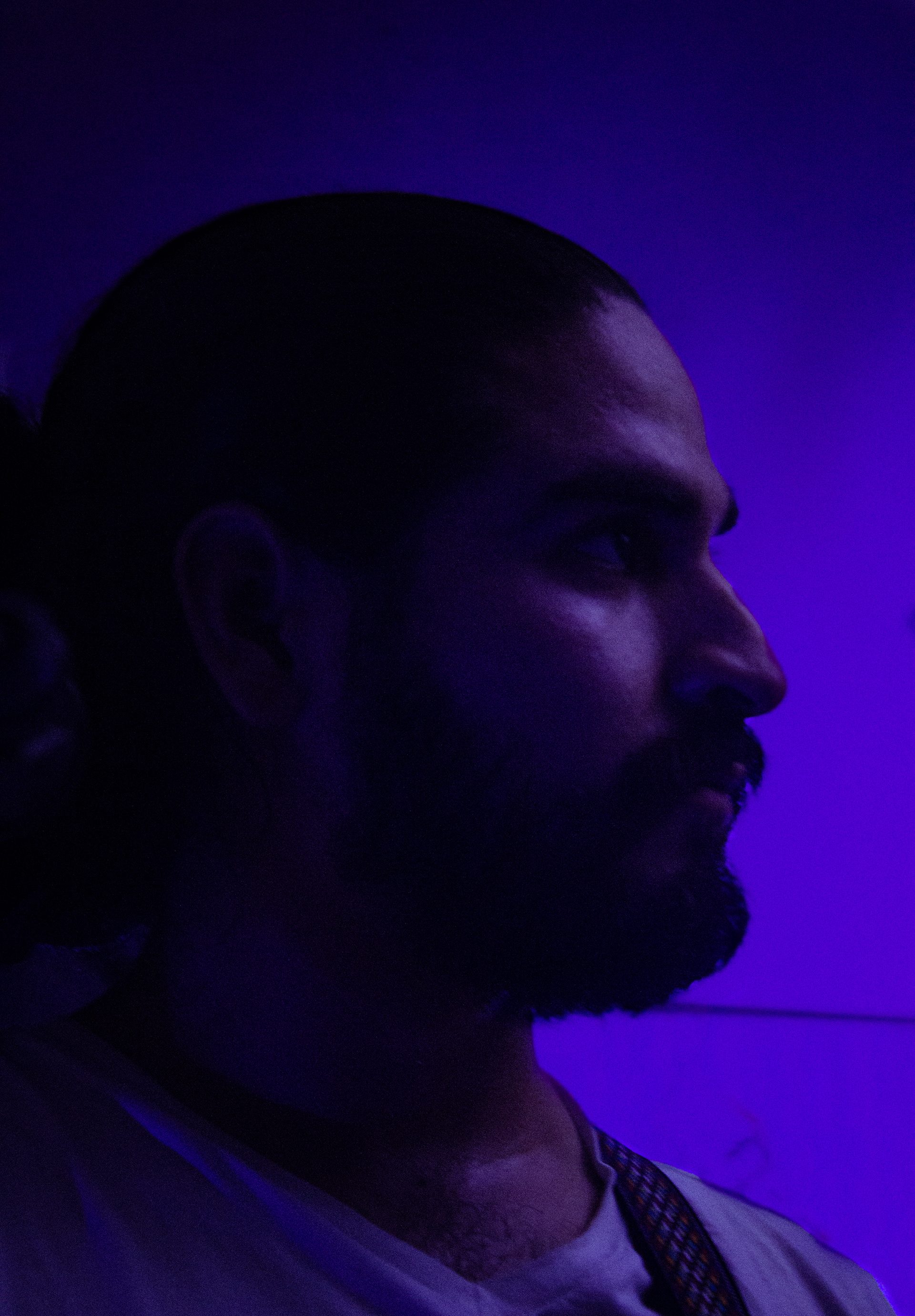 Close-Up of Pedrito