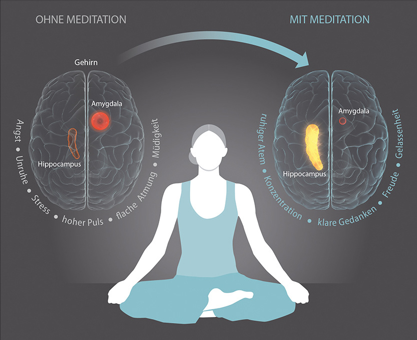Yoga und Meditation verkleinern Gehirnareal für negative Emotionen - fit for fun 03 | 2016