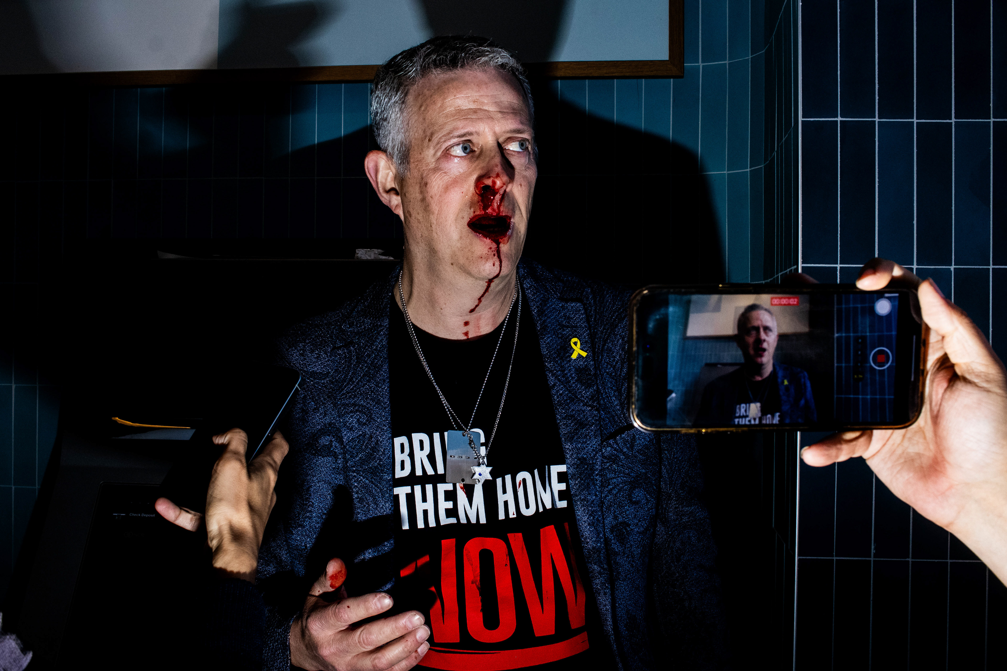 A pro-Israel counter protestor bleeding after entering into a pro Palestine rally and being hit on October 7th, 2024 in New York, New York. 