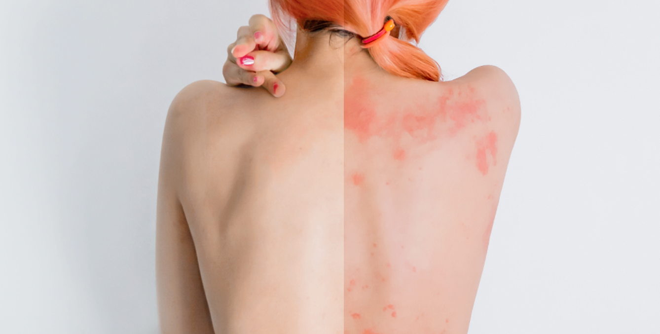 https://try.bodewellskin.com/eczema1-6/