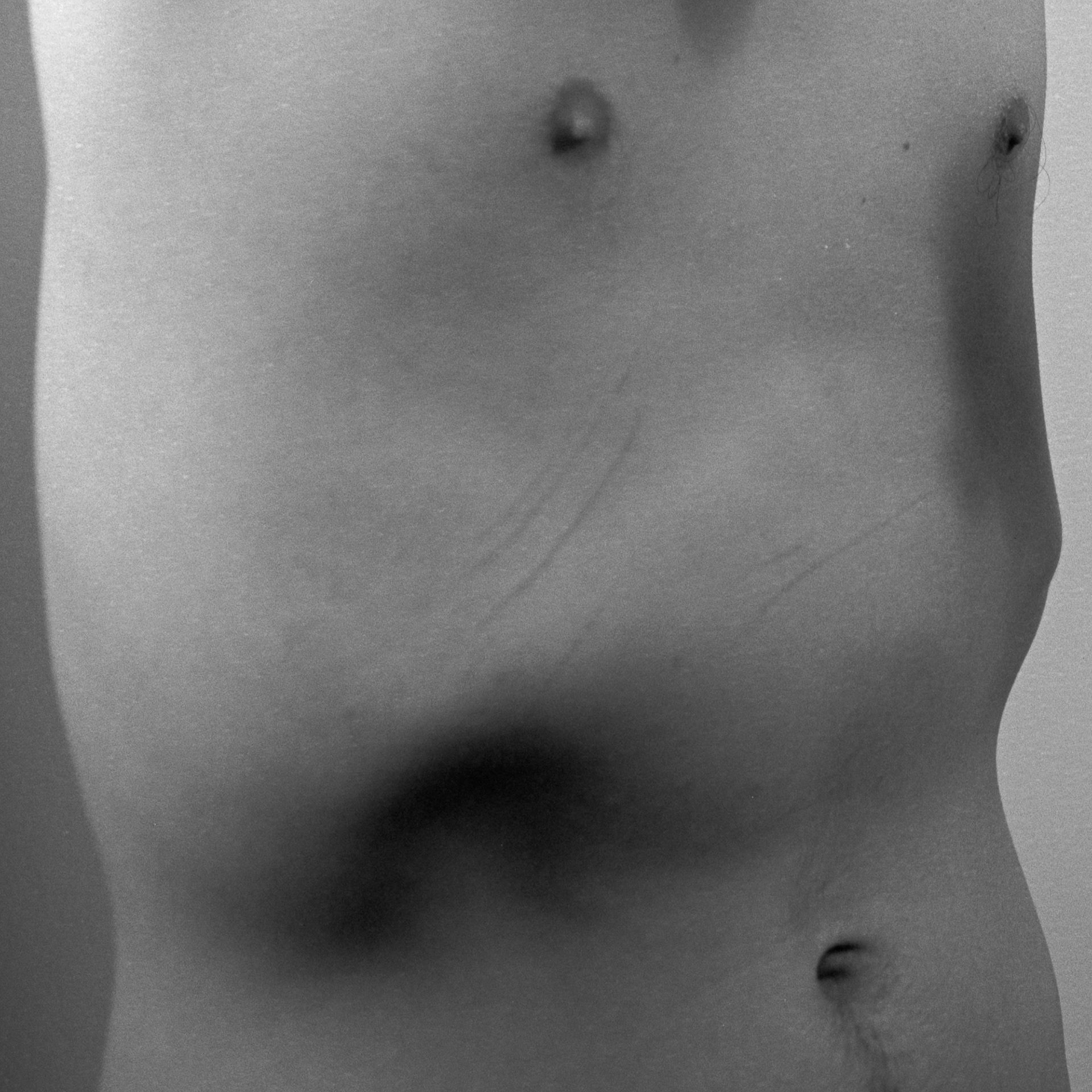 torso