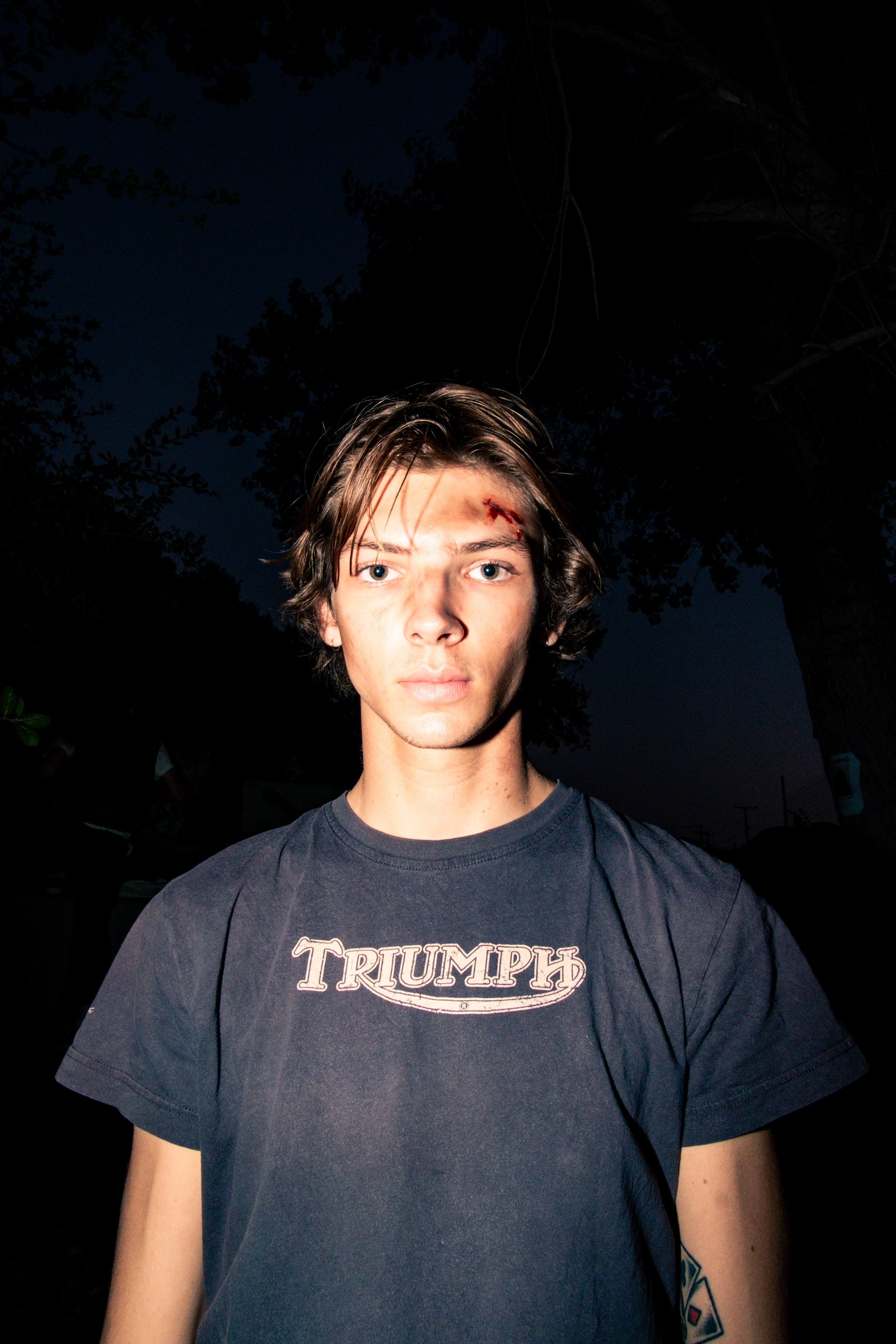 Are There Bugs in My Teeth? 2020