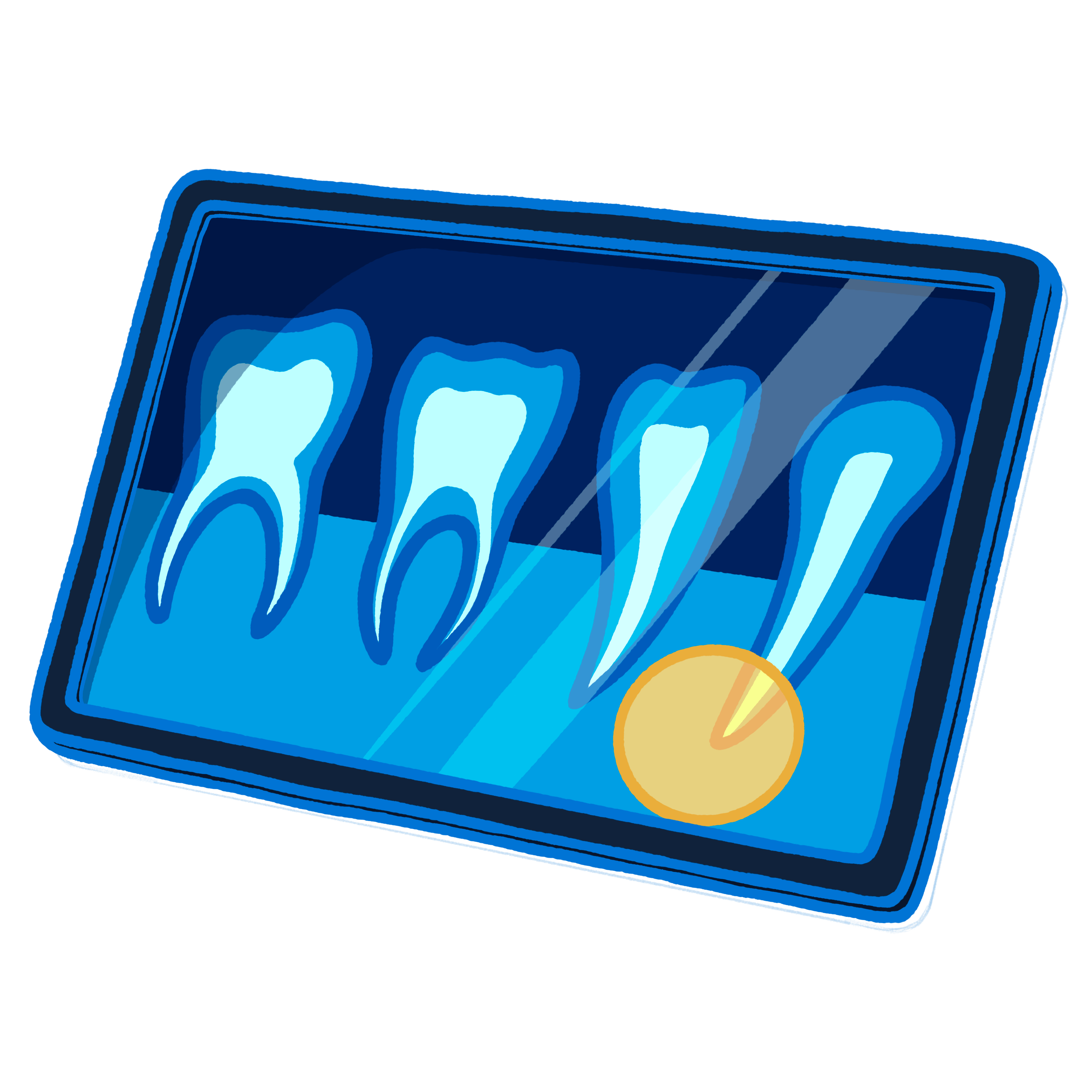 Oral Cancer Screening